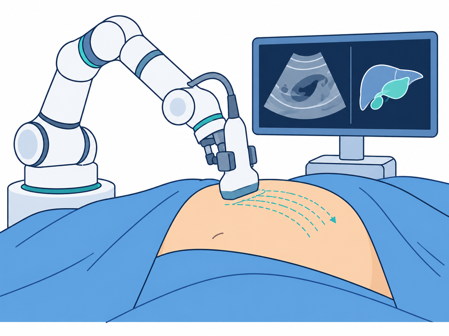 Illustration of a robot performing abdominal ultrasound