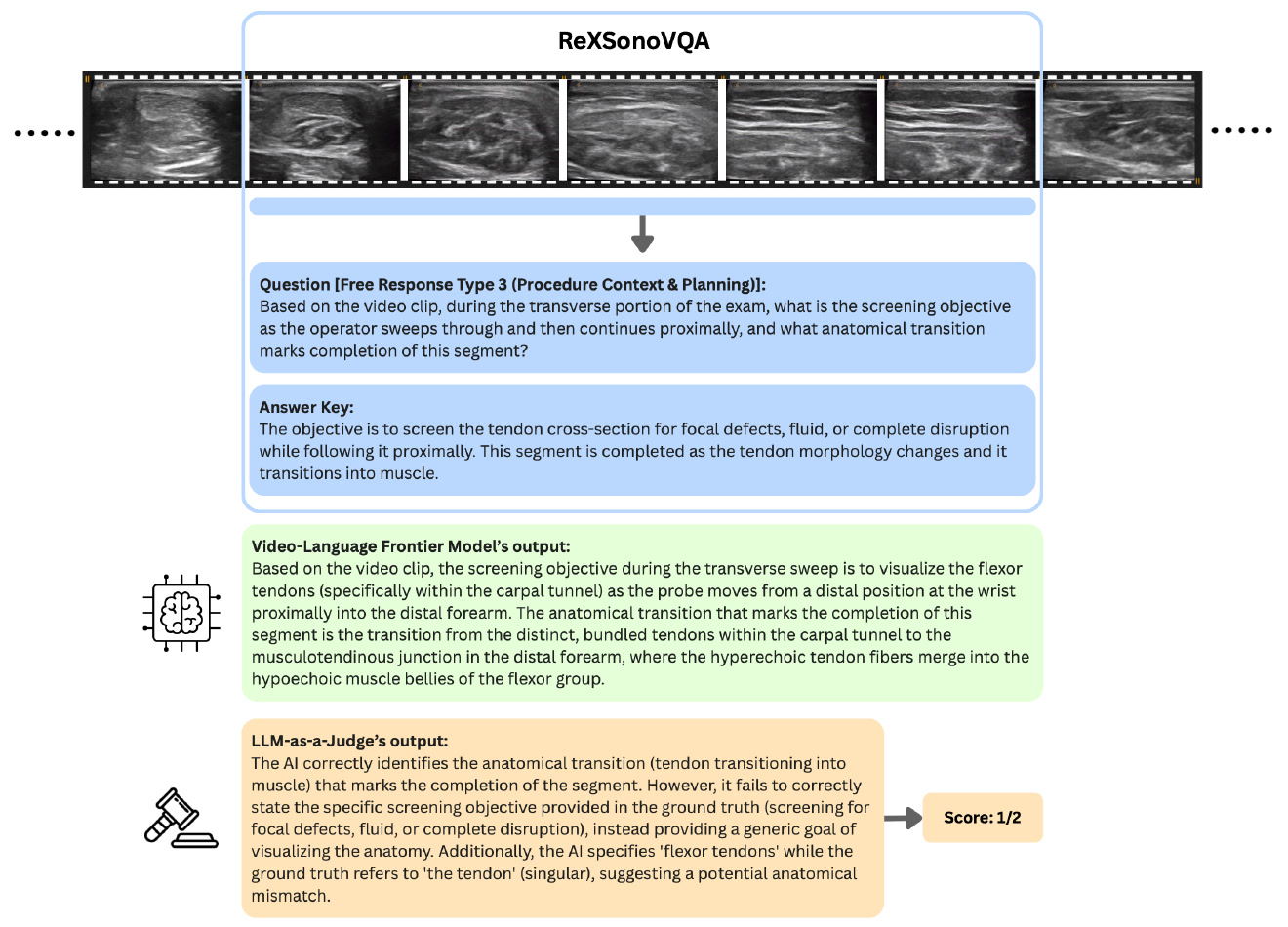 Figure 1 example from the ReXSonoVQA benchmark
