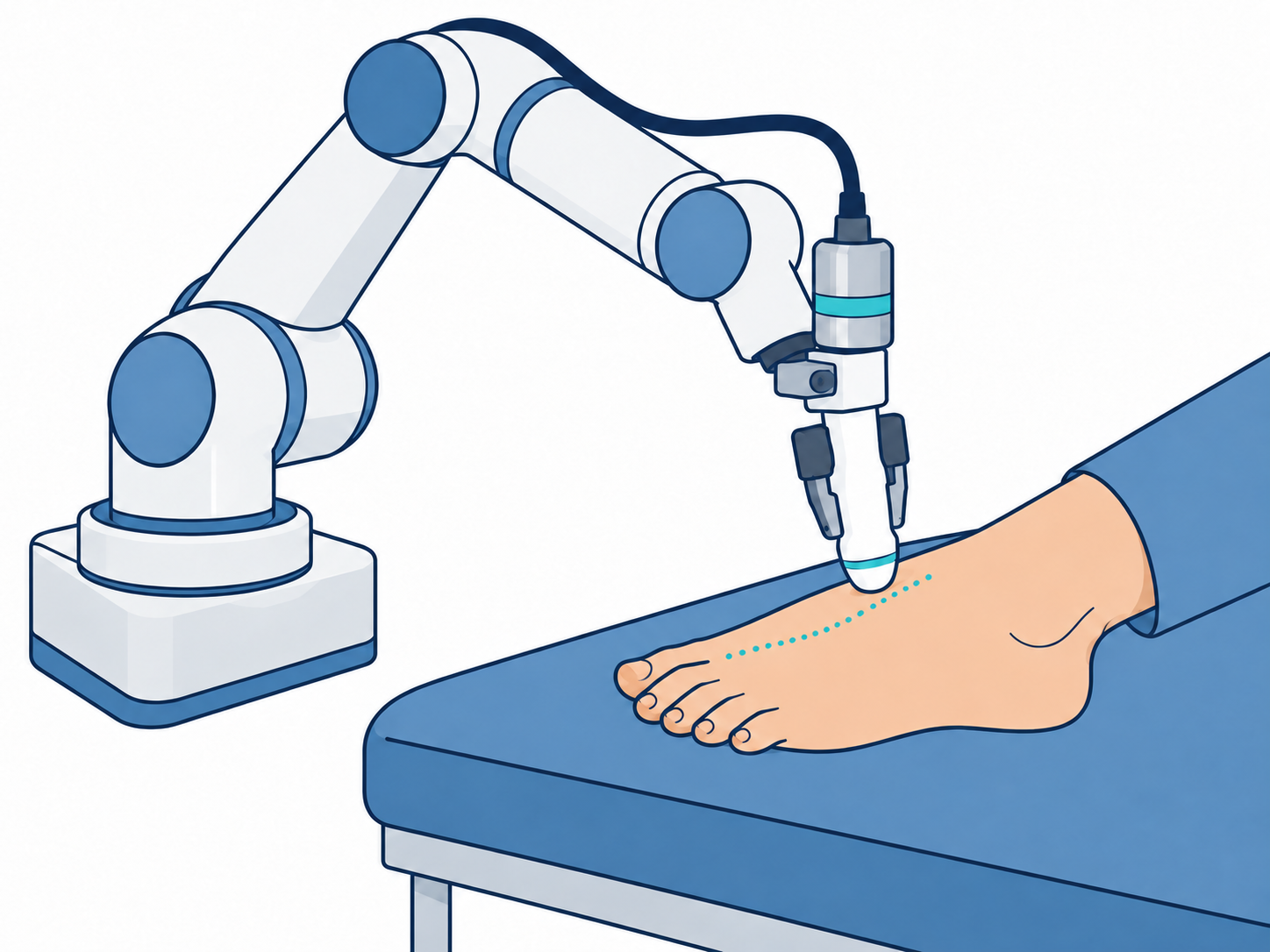 Illustration of robotic pedal Doppler assessment