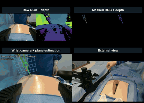 Looping SimRetract demonstration showing robotic retractor take-over